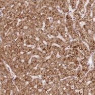 NBP1-91923 - Galectin-related protein / GRP