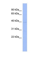 NBP1-57172 - hnRNP-A/B / HNRNPAB