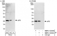 NBP1-52640 - EIF6 / ITGB4BP