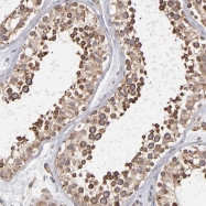 NBP1-90634 - Kinectin