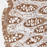 NBP1-87748 - Myosin-X