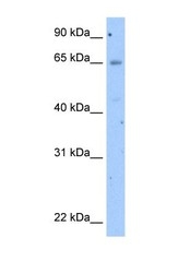 NBP1-59358 - Occludin