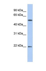NBP1-59435 - Occludin