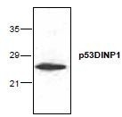 NBP1-45757 - TP53INP1