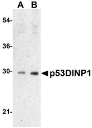 NBP1-76638 - TP53INP1