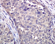 NBP1-95503 - TER ATPase / VCP