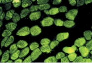 NB120-11003 - pan Actin