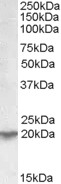 NBP1-00129 - UXT / HSPC024