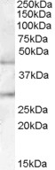 NBP1-00158 - B3GNT2 / B3GALT7