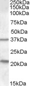 NBP1-00248 - TUSC3 / N33