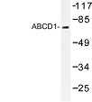 NBP1-00700 - ABCD1 / ALDP