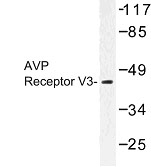 NBP1-00722 - Vasopressin V1b receptor (V1bR)