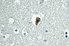 NBP1-00723 - BAI1