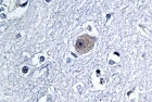 NBP1-00727 - BMP8A