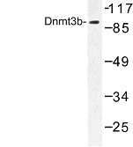 NBP1-00783 - DNMT3B