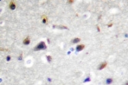 NBP1-00785 - DRP2