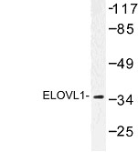 NBP1-00800 - ELOVL1