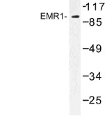 NBP1-00801 - EMR1 / TM7LN3