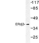 NBP1-00814 - DNAJB11