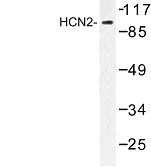 NBP1-00866 - HCN2 / BCNG2