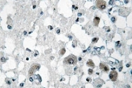NBP1-00896 - KDEL Receptor 3 / KDELR3