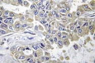 NBP1-00904 - Laminin beta-2