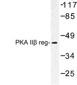 NBP1-00983 - PRKAR2B