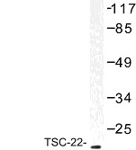 NBP1-01045 - TSC22D1