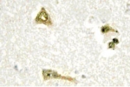 NBP1-01045 - TSC22D1