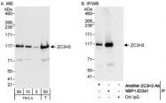 NBP1-03341 - ZC3H3