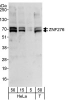 NBP1-03342 - ZFP276