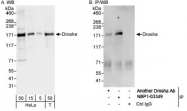 NBP1-03349 - RNASEN