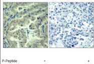 NBP1-04965 - EIF4G1 / EIF4F