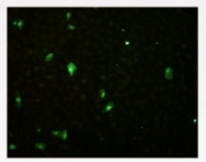 NBP1-05187 - Influenza B