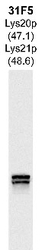 NBP1-05201 - Lys20p