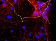 NBP1-05209 - Neurofilament H (200 kD)
