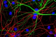 NBP1-05210 - Neurofilament H (200 kD)