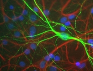 NBP1-05215 - Neurofilament H (200 kD)