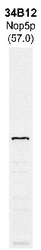 NBP1-05225 - NOP58