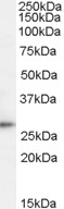 NBP1-06090 - TPD52