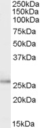 NBP1-06091 - Tumor protein D53 (TPD52L1)