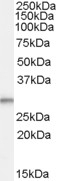 NBP1-06092 - Tumor protein D54 (TPD52L2)