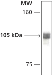 NB120-12175 - HDAC7