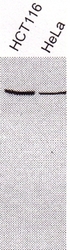 NB100-165 - XRCC3