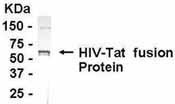 NB120-14029 - HIV-1