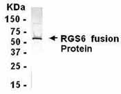 NB120-14070 - RGS6