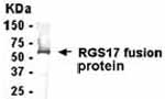 NB120-14260 - RGS17