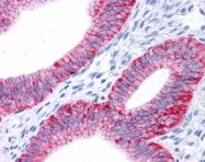 NB300-146 - ATP1A1