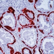 NB120-17152 - basic Cytokeratin