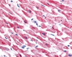 NB100-132 - HIF2A / HIF2 alpha